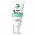Tratamiento concentrado para acne 30g