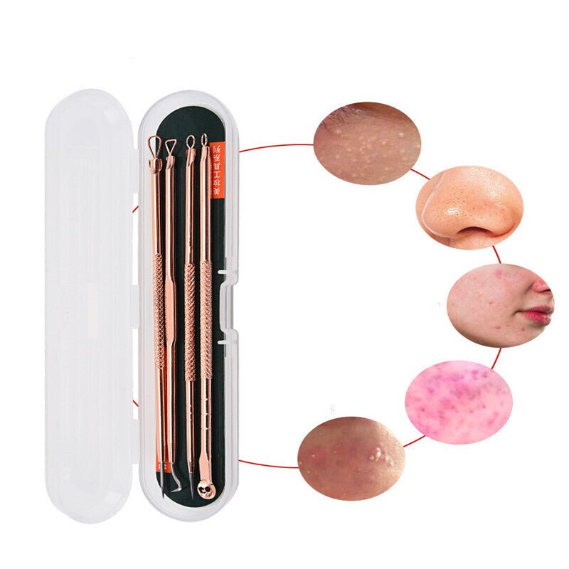 Set para acne 5 unidades - anacate